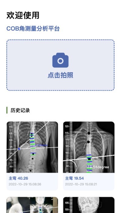 cobb角測量分析平臺 截圖2