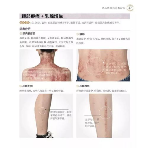 《《百分之一》刮痧组队必胜攻略，带你轻松玩转游戏！》 1