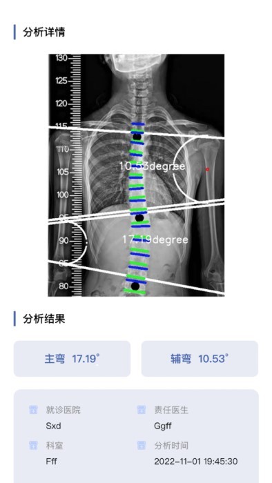 cobb角測量分析平臺 截圖4